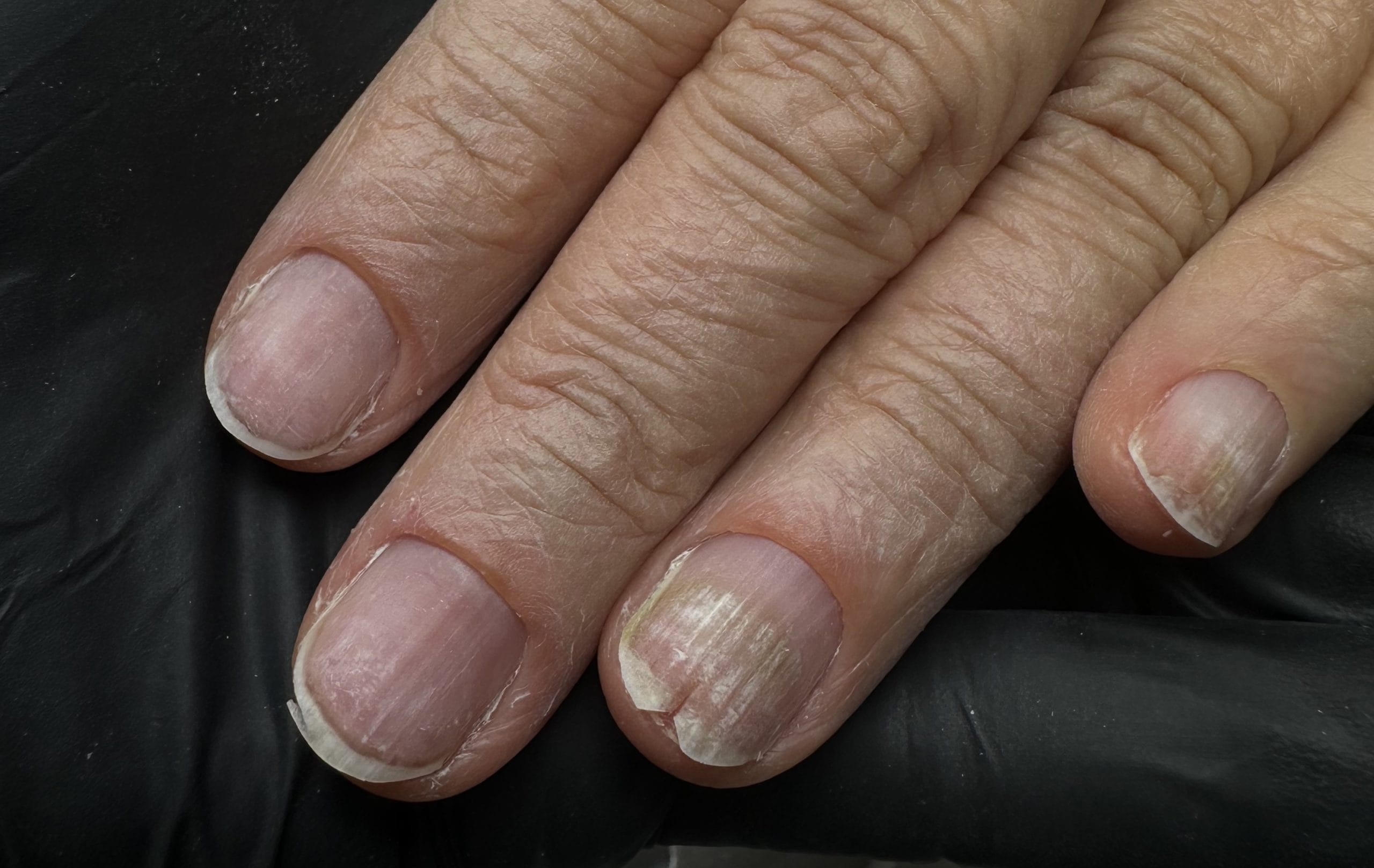 Uñas estriadas, frágiles y que se enganchan: el tratamiento que las estabiliza